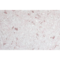 Рідкі шпалери Новий-Тон 11 рожеві